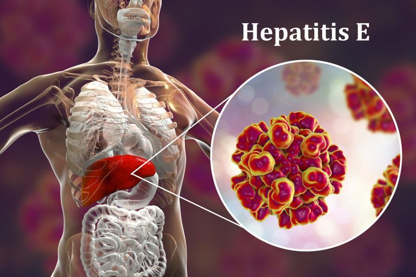 ¿Habías oído hablar de la hepatitis E?